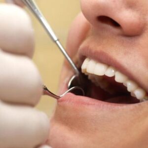 Close-up of a dentist examining a patient’s teeth with dental tools.